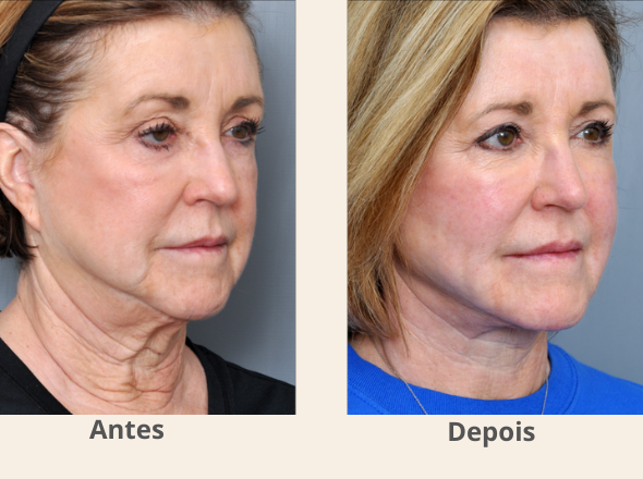 tratamentos 590 x 440 pescoço